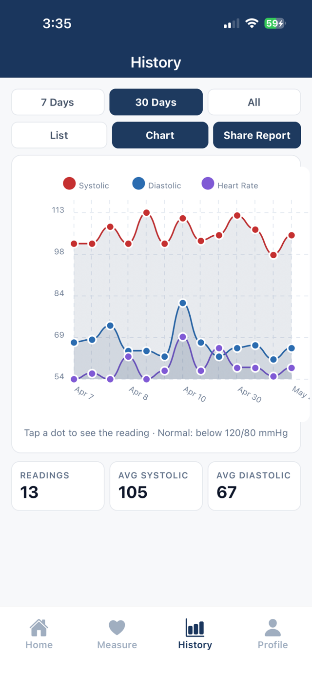 History chart plotting systolic, diastolic and heart rate over 30 days